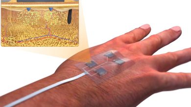 AI Powered Smart Bandages on the Horizon