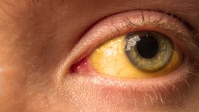 can drugs cause jaundice