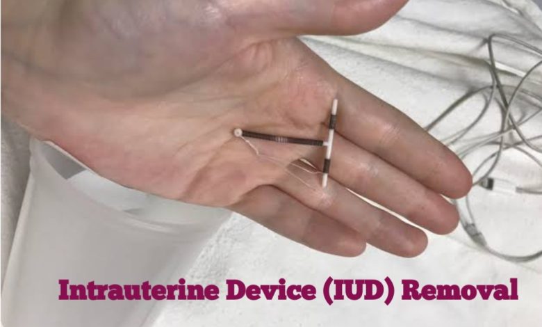 Does It Hurt To Take Out an IUD