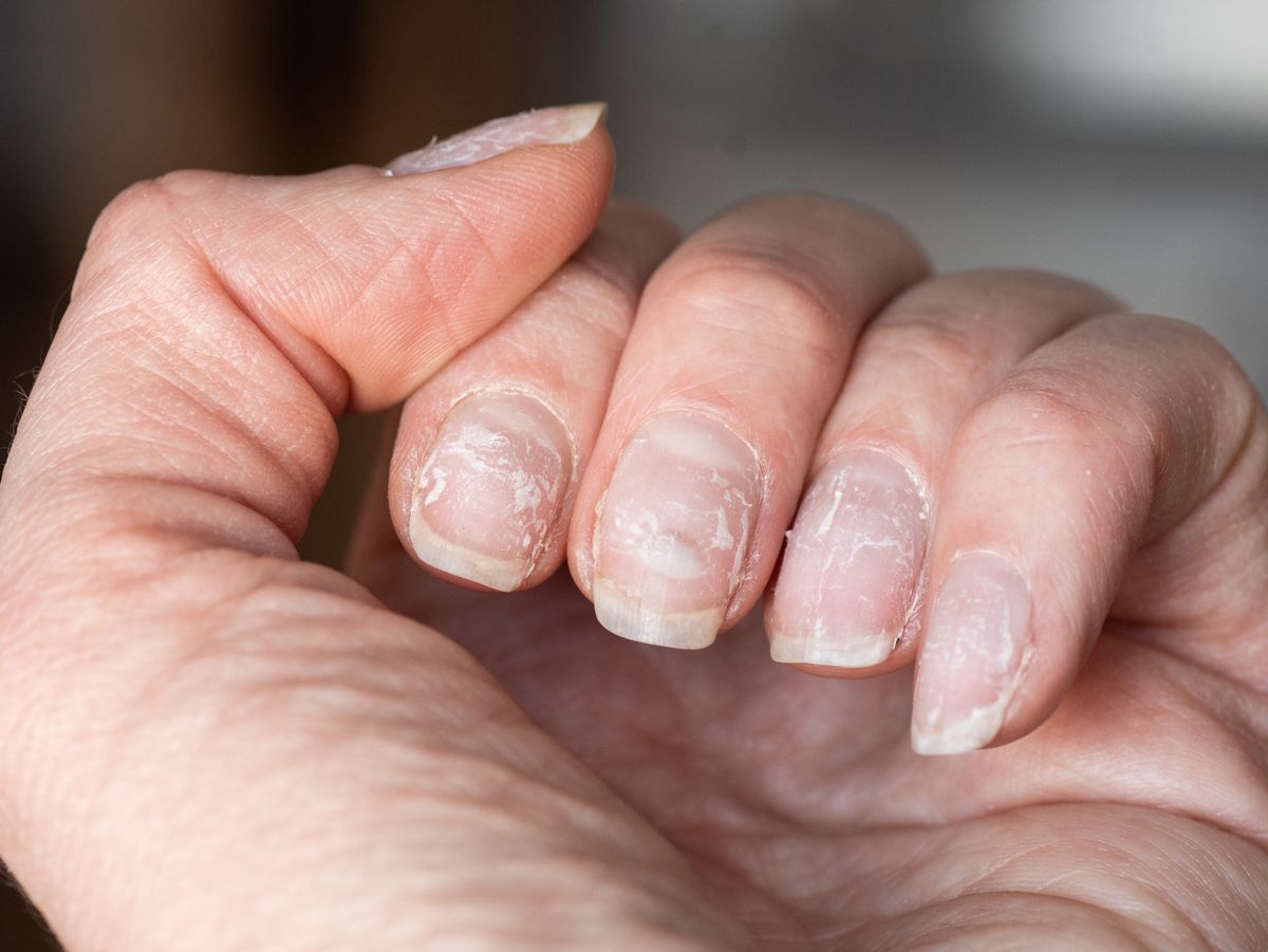 Drugs That Can Affect The Appearance Of Your Finger and Toe Nails