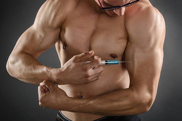 Injecting Steroids