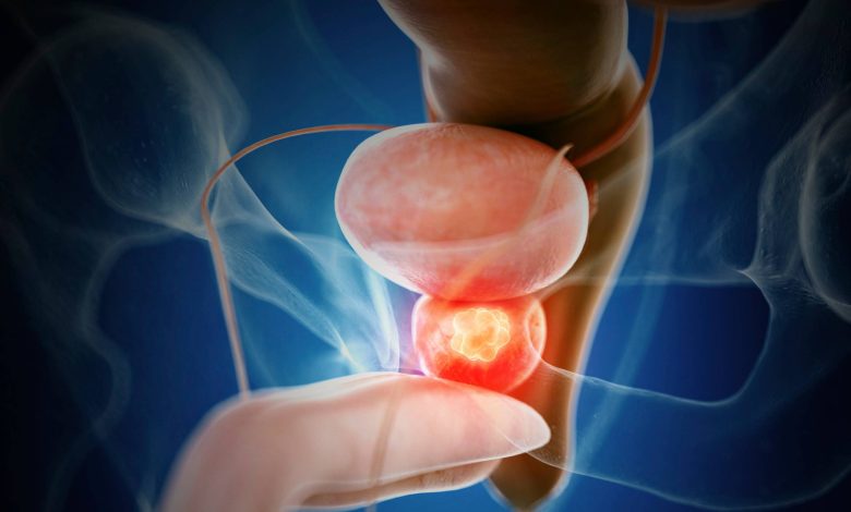Sumitomo Pharma's ORGOVYX Receives Health Canada Approval for Advanced Prostate Cancer Treatment