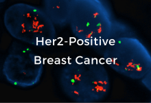 Metastatic HER2 Positive Breast Cancer Market to Grow by 2032 at a 5.2% CAGR