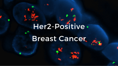 Metastatic HER2 Positive Breast Cancer Market to Grow by 2032 at a 5.2% CAGR
