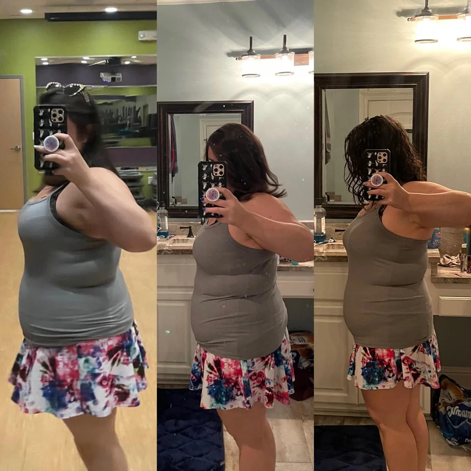 A Reddit user shared her Mounjaro success story of how she lost 22lbs (10kg) in 3 months