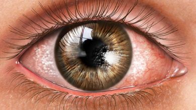 Stuart Therapeutics Unveils Breakthrough Phase 3 Clinical Trial for Vezocolmitide, a Potential Game Changer in Dry Eye Disease Treatment