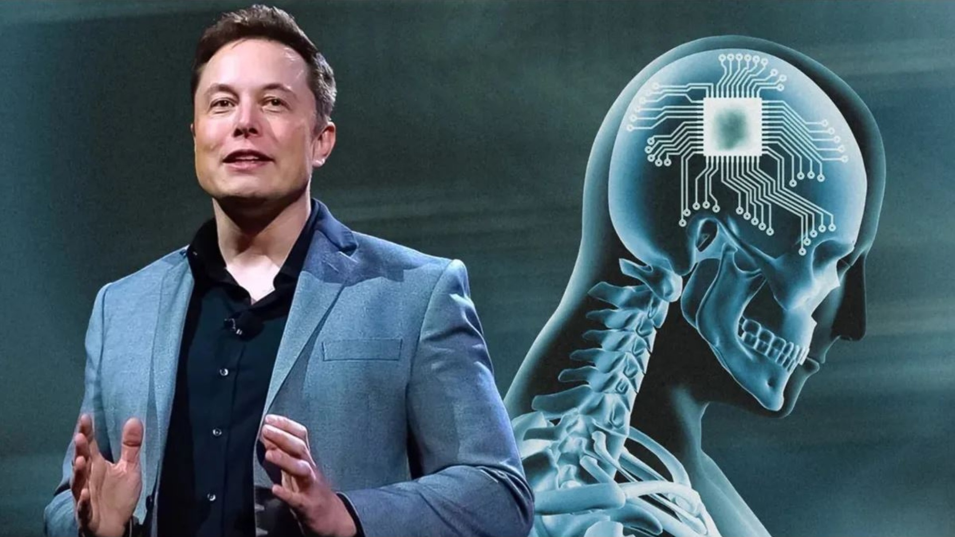 FDA Raises Concerns Over Animal Lab Issues at Musk's Neuralink